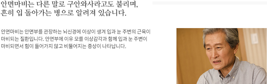 안면마비