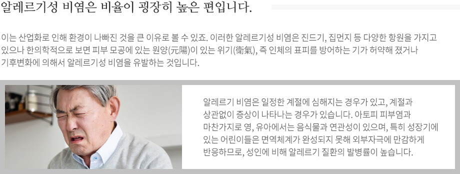 알레르기성 비염