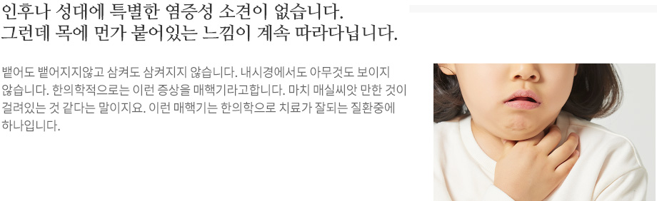 목이물감(매핵기)