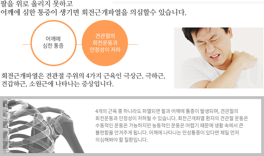 회전근개파열