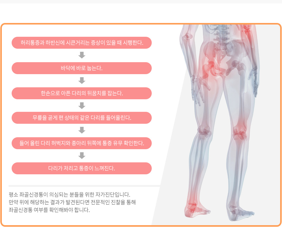 좌골신경통 자가진단 방법