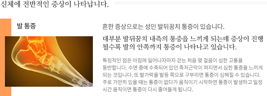 족저근막염 대표적인 증상