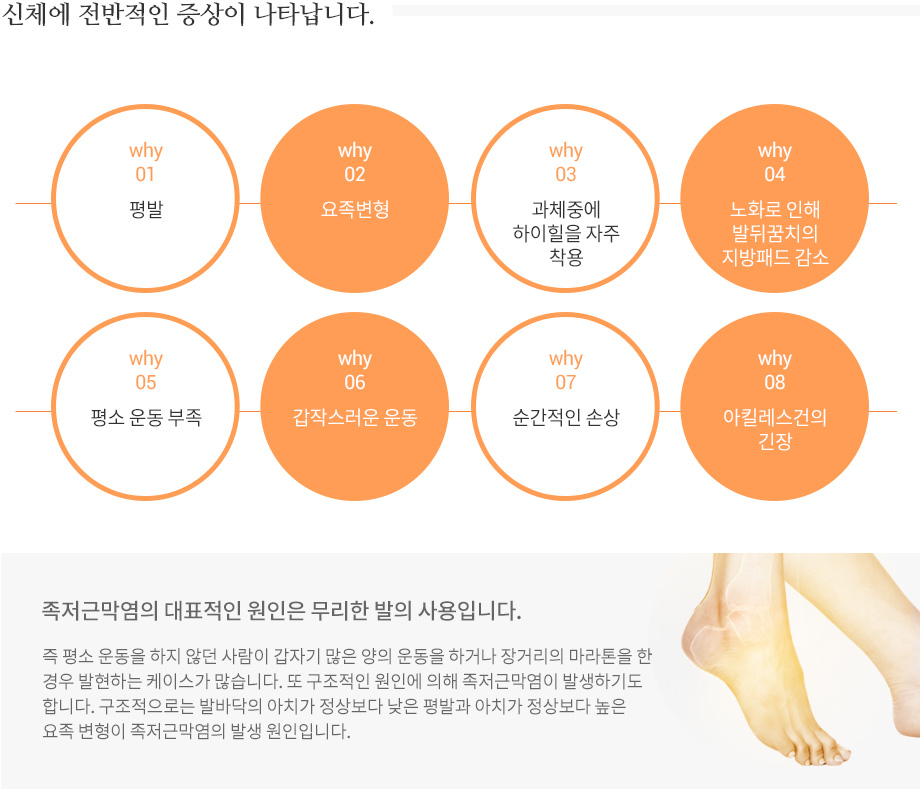 족저근막염 발생원인